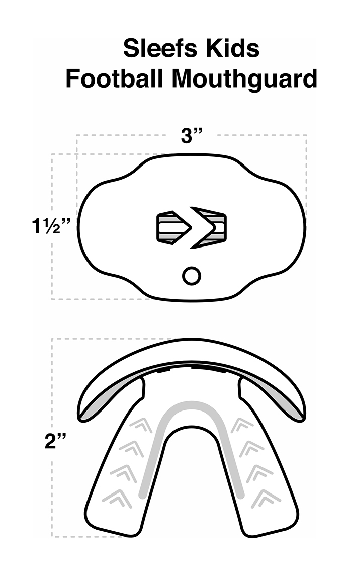 Mouthguard Mouthguard
